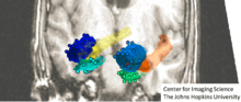 FIgure showing different examples of shapes and forms in Computational Anatomy from MR imager.