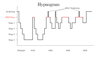 Hypnogram showing sleep cycles from midnight to morning.