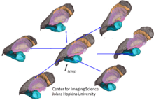 figure depicting multiple coordinate systems generated from MRI images and generating a common template coordinate system.