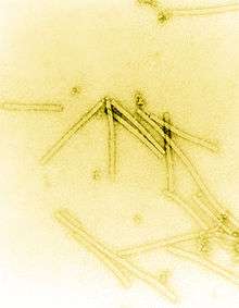 Electron micrograph of rod shaped TMV particles.